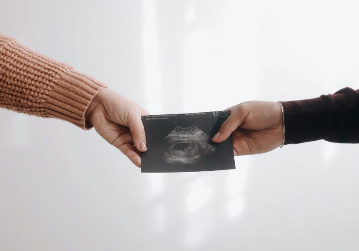 handing a picture of an ultrasound conceiving in Italy